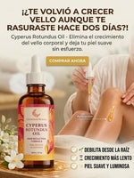 CARAMELA CYPERUS: La alternativa natural al láser que realmente funciona